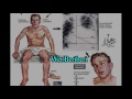 thiamine deficiency beriberi. dry beriberi vs wet beriberi