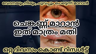 Chenkannu treatment in Malayalam | chenkannu maran | ചെങ്കണ്ണ് മാറാൻ