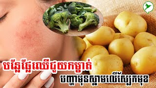 បន្លែផ្លែឈើ៣មុខ ត្រូវបានគេជឿថា មានសមត្ថភាពជួយកម្ចាត់បញ្ហាមុនស្នាមលើស្បែកមុខគ្មានសល់/Eat Healthy