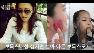 보톡스내성 생기면 설마 다른 보톡스도?