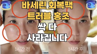 바세린에 이것만 섞어도  피부가 하얘지고 노화 피부가 살아납니다 !!! 젊어지는 홈케어 비법! 바세린만 바르면 트러블 나는 분들 필수 시청!!!!