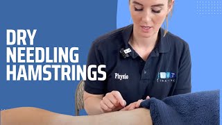 Dry Needling - Hamstrings