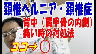 頚椎ヘルニア、頚椎症（頚椎症性神経根症）で背中（肩甲骨の内側）が痛い時の対処法