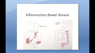 Pathology 568 a Crohns Disease Ulcerative Colitis Difference Pathology Inflammatory Bowel Disease