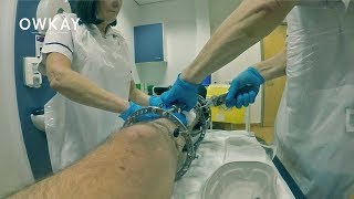 Hospital Trip 2 | External Fixator Cage Removal without Surgery