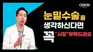 눈밑수술 하실려고 병원 알아보시죠?