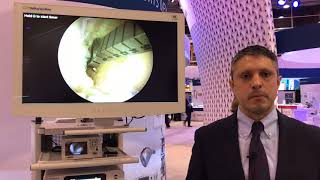 Digital Surgery Solutions: DePuy Synthes PUREVUE Visualization System for Imaging in MIS