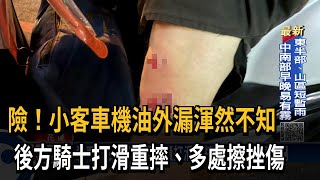 險！小客車機油外漏渾然不知　後方騎士打滑重摔、多處擦挫傷－民視新聞