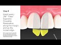 3M™ Filtek™ Dental Restoratives and Bioclear®