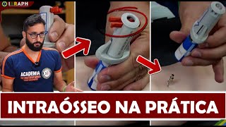 Como obter um Acesso Intraósseo na Prática com o B.I.G