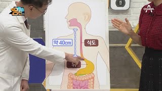 식도와 위 사이에서 관문 역할을 하는 식도 하부 괄약근의 기능! | 나는 몸신이다 354 회