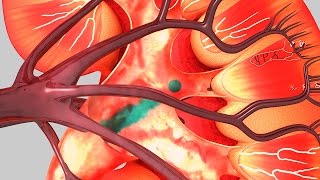 Human Physiology - Distal Convoluted Tubule and Collecting Duct: Sodium and Chloride Reabsorption