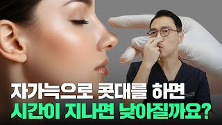 289화.  자가늑연골로 만든 콧대, 코끝!!!!  시간이 지나면 낮아질까?