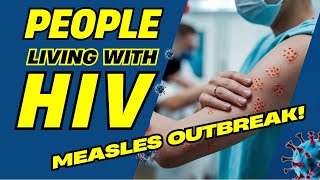 Measles Outbreak and People Living with HIV