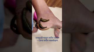 टाचदुखी -त्वरित आराम (3)