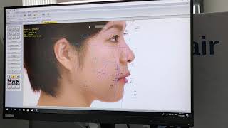 V CEPH Software Training Video by Osstem Implant India