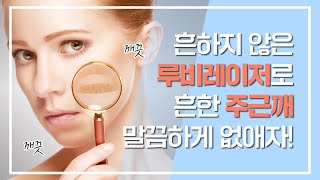 흔하지 않은 루비레이저로 흔한 주근깨 말끔하게 없애자