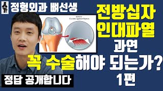 어느 정형외과 의사가 정리한 [전방십자인대 파열, 꼭 수술해야 되는가?] 1편