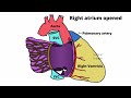 Anatomy of Right Atrium (Cardiac Morphology: Chapter 1)