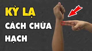 Quá Kỳ Lạ Với Cách Chữa Hạch Vô Cùng Hiệu Quả Này | HYT3