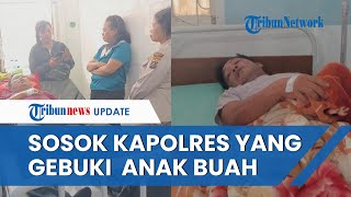 Sosok AKBP Reinhard Kapolres Dairi Diduga Aniaya 2 Anggotanya hingga Bonyok, Bungkam saat Ditanya