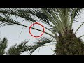 date palm thorn excision from left hand left hand foreign body removal