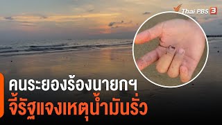 คราบน้ำมันติดตัวนักท่องเที่ยว หลังลงเล่นน้ำหาดแม่รำพึง (14 ก.พ. 65)