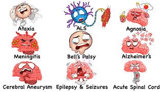 Every Deadly Brain Disorder Explained in 18 Minutes