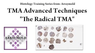 Introduction To The Radical Tissue Microarray