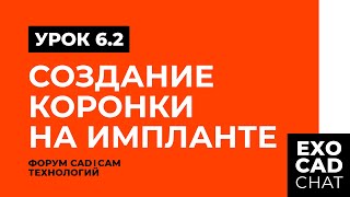 EXOCAD: БЕСПЛАТНЫЙ КУРС | УРОК 6: СОЗДАНИЕ КОРОНКИ НА ИМПЛАНТЕ (ЧАСТЬ 2)