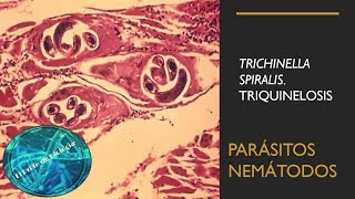 Trichinella Spiralis  Triquinelosis  Parásitos nemátodos