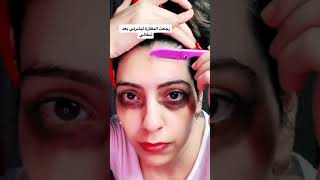 تنظيف عميق للبشرة 🤟🤟💜