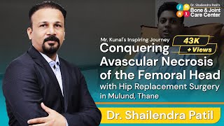 Mr.Kunal Success Story || Avascular Necrosis Femoral Head || Hip Replacement Surgery in Mulund,Thane