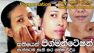 The Best Home Remedy for Pigmentation | නිවසේදීම පිග්මන්ටේෂන් වලට හරිම සත්කාරය