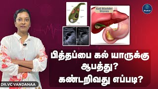 பித்தப்பை கல் யாருக்கு ஆபத்து? கண்டறிவது எப்படி? | Dr. VC Vandanaa