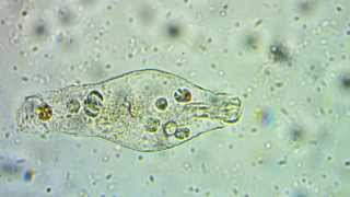 Rotifer Observations - Unidentified movement