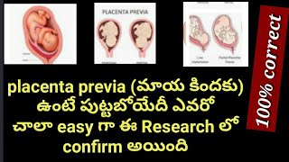 మాయ కిందకు ఉంటే పుట్టబోయేదీ ఎవరో ఈ Researchలో easyగా confirm చెసారు|Placenta previa link with gender