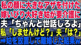 【スカッとする話】私の顔に大きなアザを付けた、嫁いびり大好き姑が要介護に。夫「ちゃんと世話しろよ」私「しませんけど？」夫「は？」➡︎姑を放置して離婚した結果w