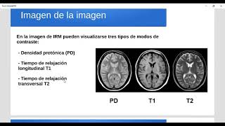 Intro Imagenología 1400: Generalidades del estudio de magnética parte 1