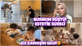 BURUN ESTETİĞİ VE 7 YIL TEL TEDAVİSİ SÜRECİM, BURNUM DÜŞTÜ, KIZ KARDEŞİM GELDİ, MUTFAK DOLAP DÜZENİ