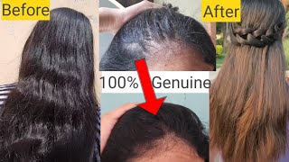 This MAGICAL POTLI will help you Grow HAIR SUPER FAAST!! Try This NOW! - Hair Remedy-  Glow Yourself