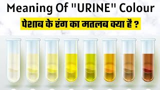 what is the meaning of urine colour ? || पेशाब के रंग का मतलब क्या है ?