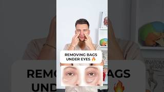 REMOVING UNDER EYE BAGS❤️‍🔥 #undereyedarkcircles #eyebags #undereyebags #eyewrinkles #facefitness