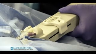Breast Cancer Treatment: How Intraoperative Radiation Therapy (IORT) works