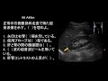 【診療放射線技師国家試験】直前演習 2014 am