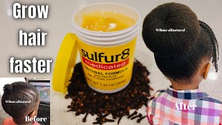 How to use SULPHUR 8 & Cloves for Massive hair growth! Mix Sulphur 8 & cloves for Hair Growth