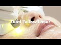 Natasha Skincare | Dual Yellow Laser | Teleangiectacia | Spider Vein | dr. deka