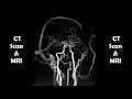 MRI 3D  Neck & cerebral vasculature