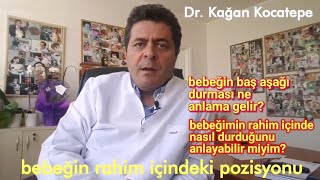 Bebeğin rahim içinde nasıl durduğunu anlayabilir miyim? Baş aşağı durması erken doğum belirtisi mi?