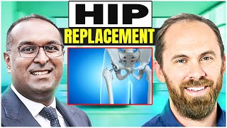 Hip Replacements | Everything you need to know!